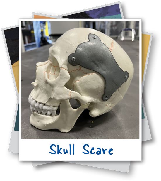 fake skull with metal plate drilled on